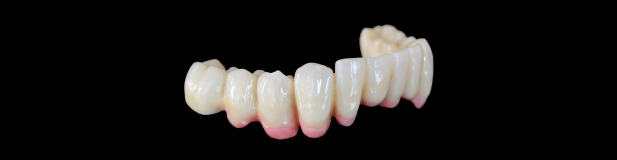 Lucrare din Multi Translucent PLUS